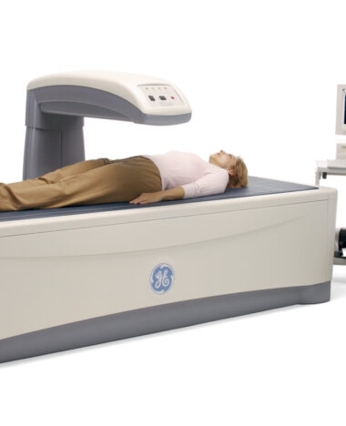 DEXA
