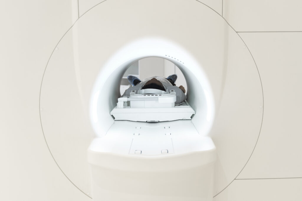 PET Scan