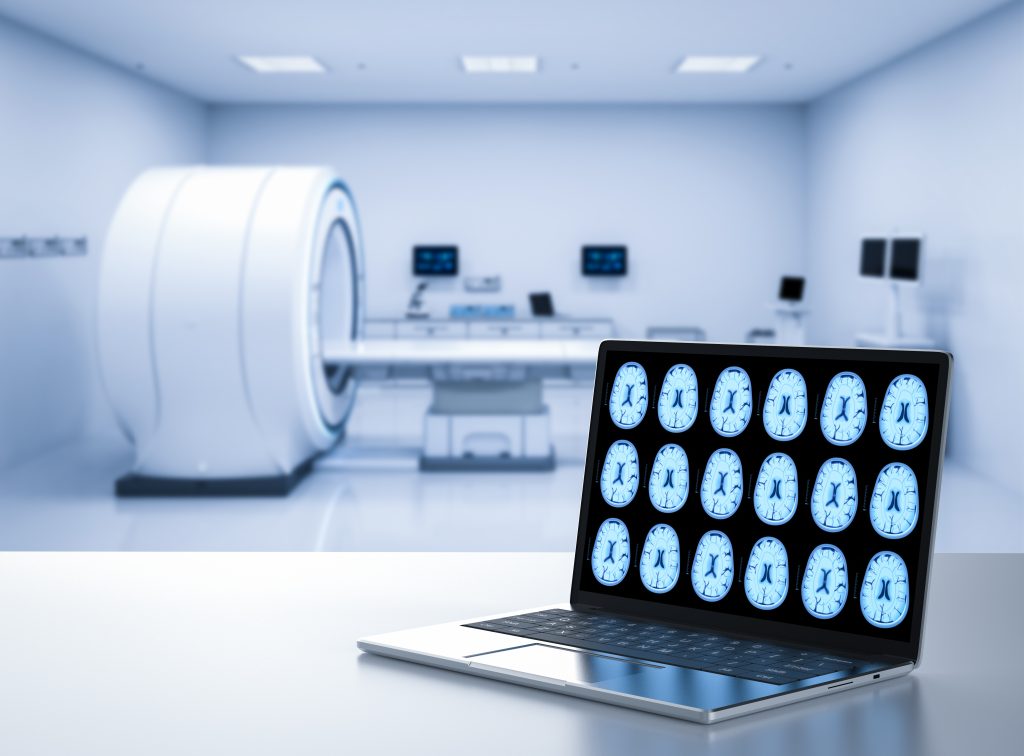 MRI Price in India