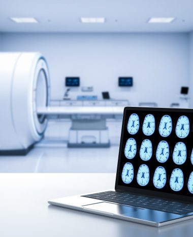 MRI Price in India