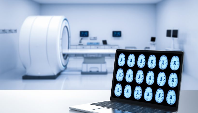 MRI Price in India