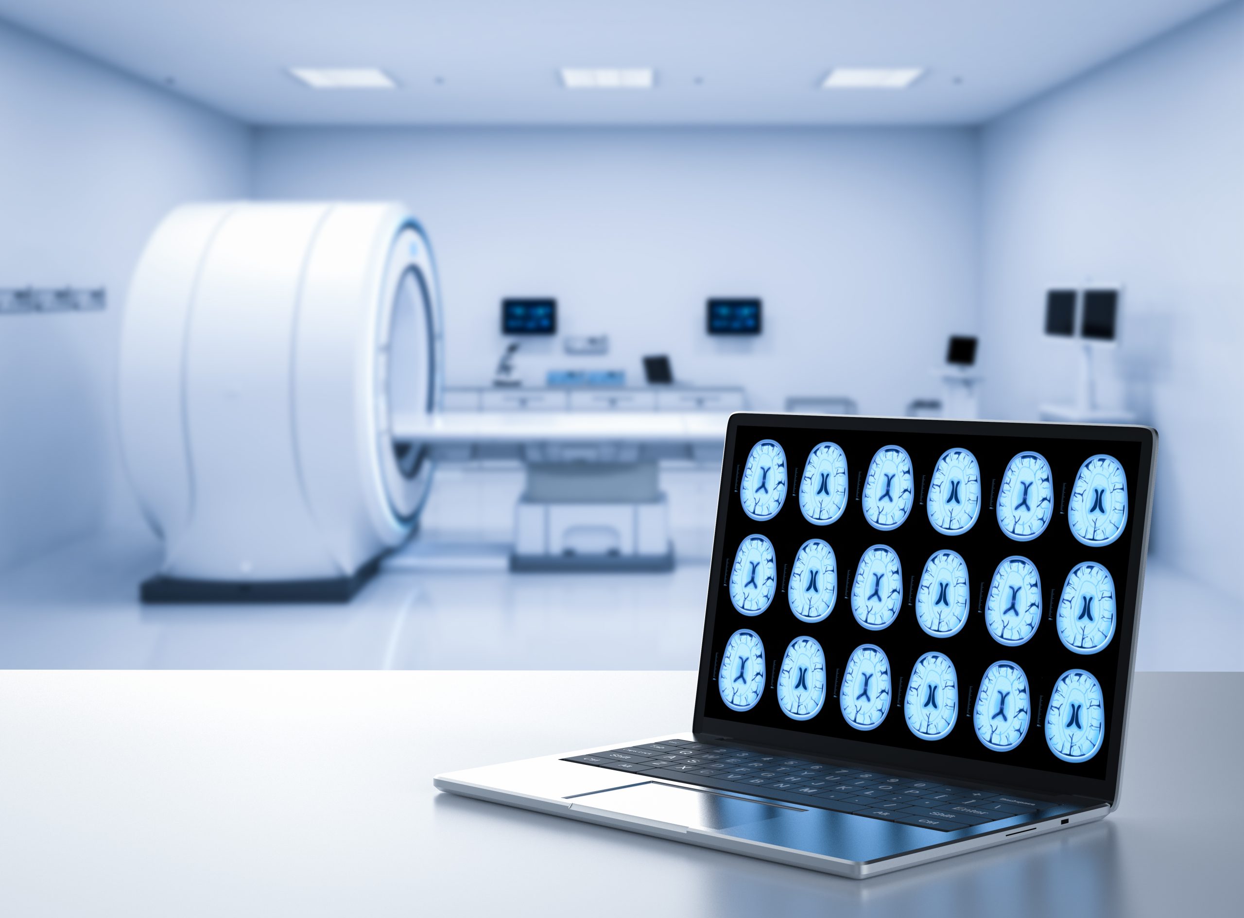 MRI Price in India